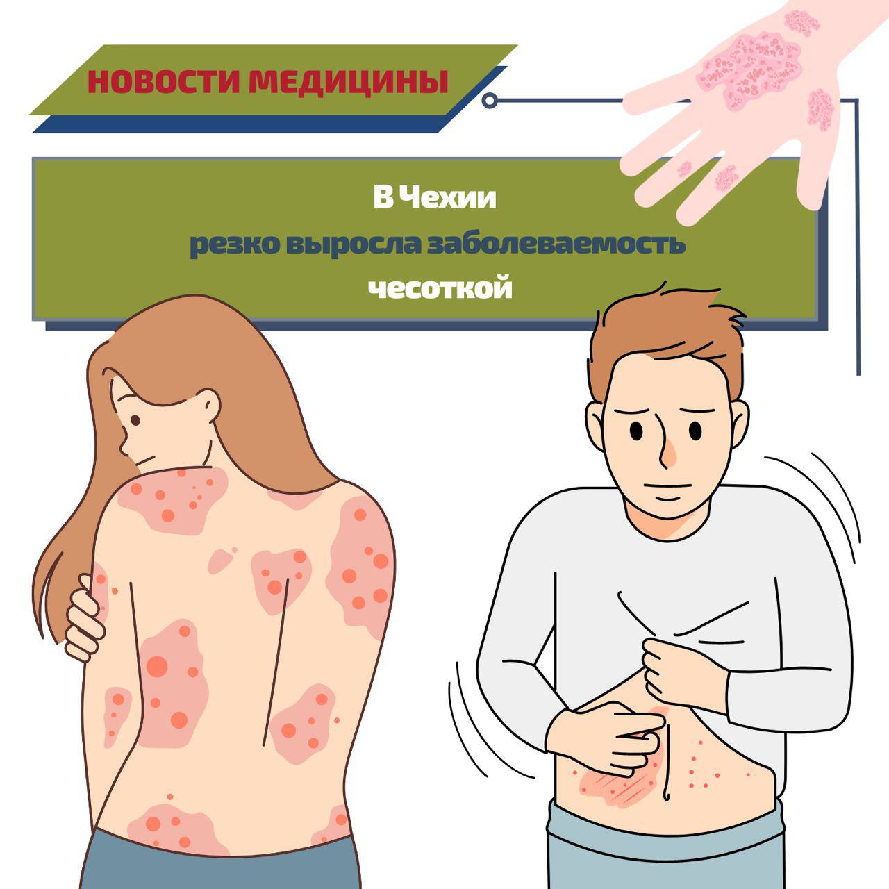 Новости медицины - чесотка - Клиника в Праге MEDICA MENTE