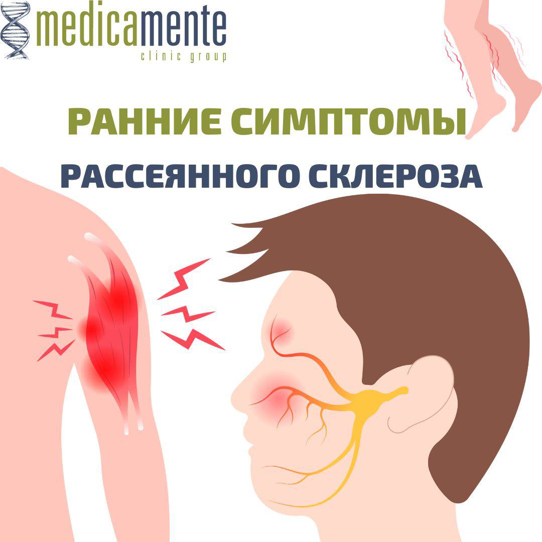 Ранние симптомы рассеянного склероза - Клиника в Праге MEDICA MENTE