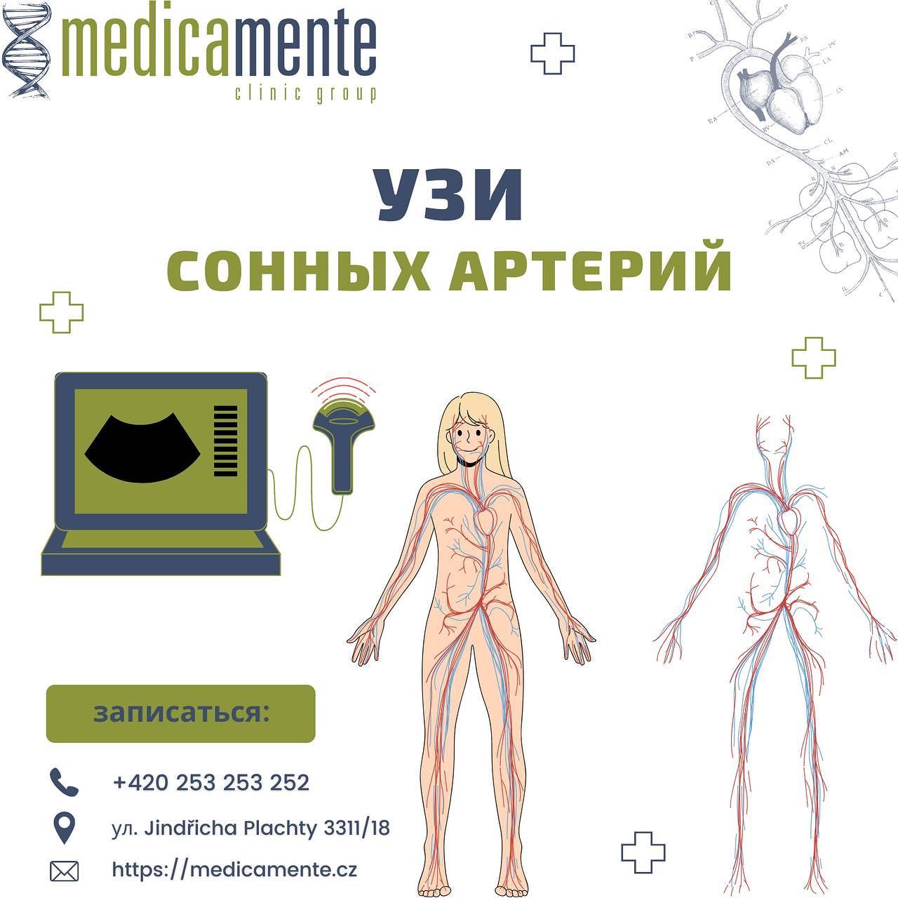 УЗИ СОННЫЙХ АРТЕРИЙ - Клиника в Праге MEDICA MENTE