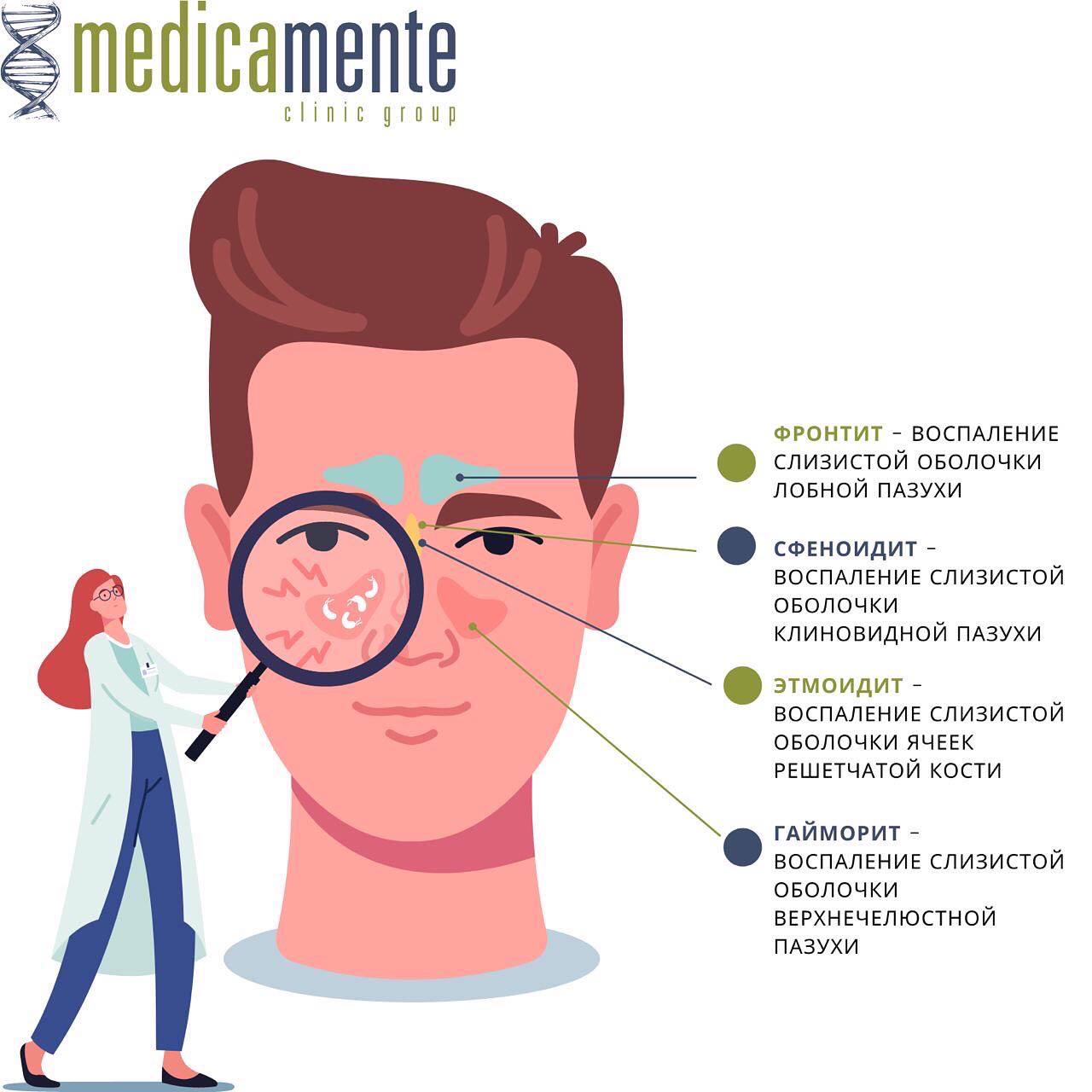 Хронический синусит - Клиника в Праге MEDICA MENTE