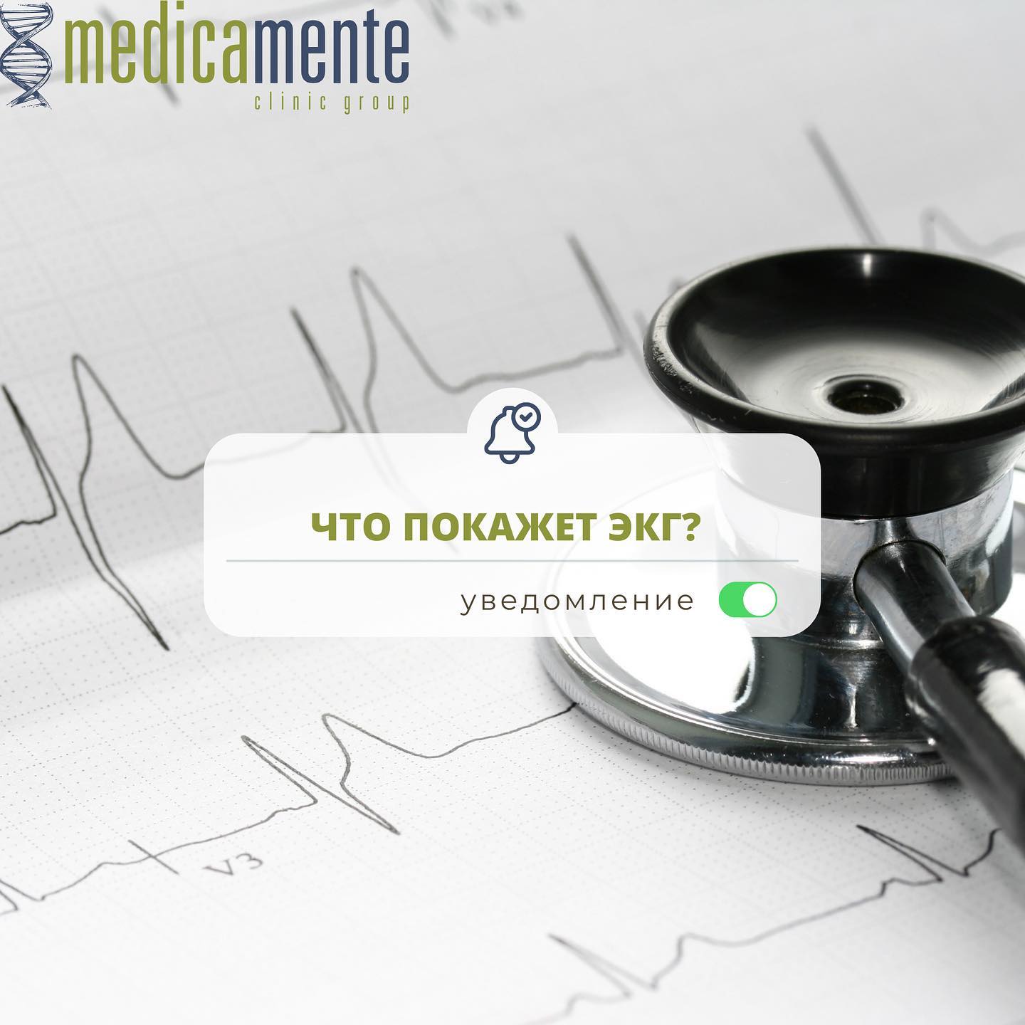 Что такое ЭКГ? - Клиника в Праге MEDICA MENTE