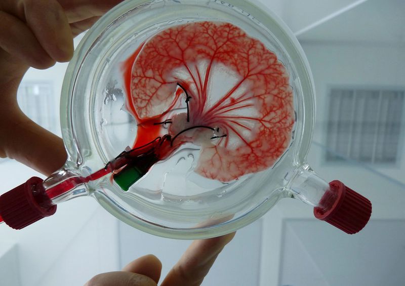 Regenerative therapy may replace organ transplantation.